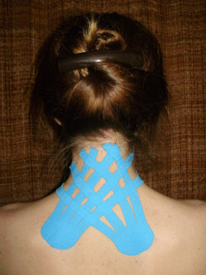 Kinesiotaping